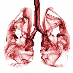 Understanding Lung Cancer 